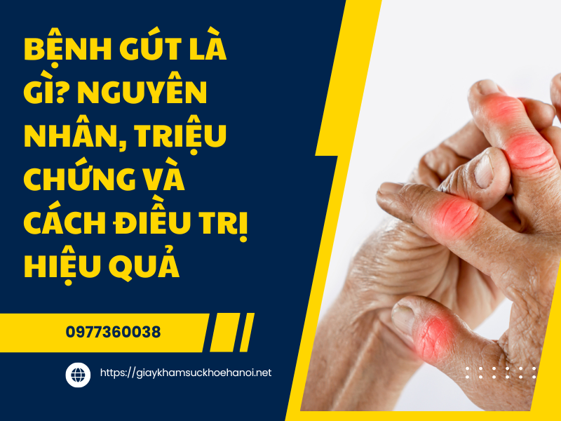 Bệnh gút là gì? Nguyên nhân, triệu chứng và cách điều trị hiệu quả