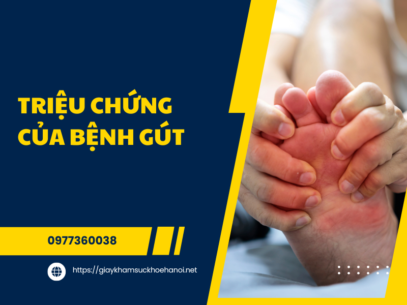 Bệnh gút là gì? Nguyên nhân, triệu chứng và cách điều trị hiệu quả