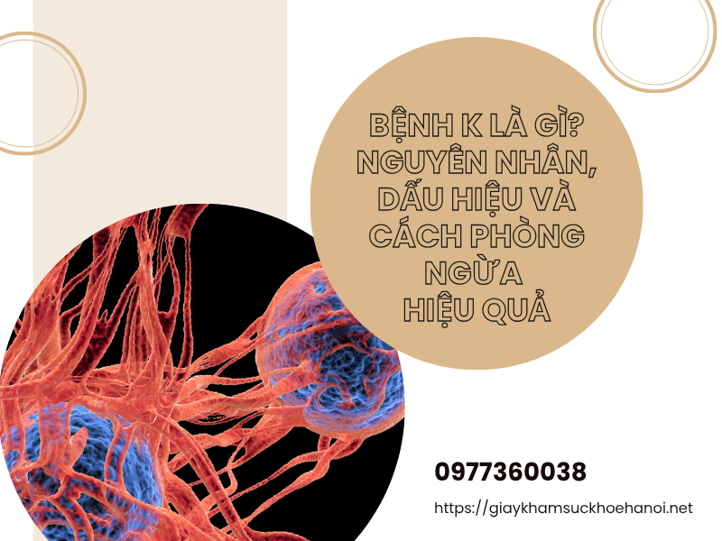 Bệnh K là gì? Nguyên nhân, dấu hiệu và cách phòng ngừa hiệu quả